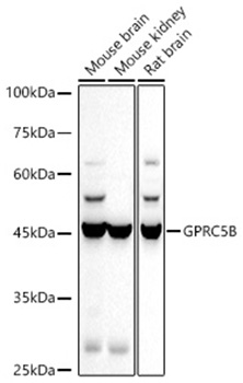 GPRC5B Monoclonal Antibody [8Y9J4]