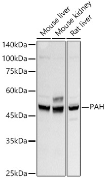 PAH Monoclonal Antibody [4J7E8]