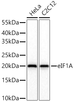 eIF1A Monoclonal Antibody [7G7Y3]