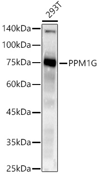 PPM1G Monoclonal Antibody [9T9H5]
