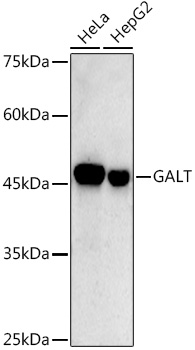 GALT Monoclonal Antibody [2R0A8]