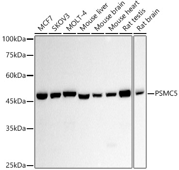 PSMC5 Monoclonal Antibody [1J6T2]