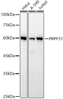 PRPF31 Monoclonal Antibody [6J9S2]