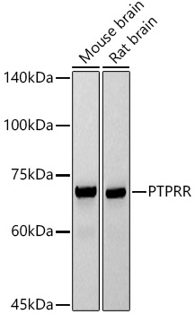 PTPRR Monoclonal Antibody [5R6L5]