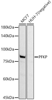 PFKP Monoclonal Antibody [5B7E3]