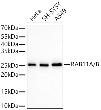 RAB11A/B Monoclonal Antibody [8T4A9]