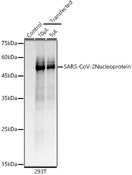SARS-CoV-2 Nucleoprotein Monoclonal Antibody [4F4Z10]