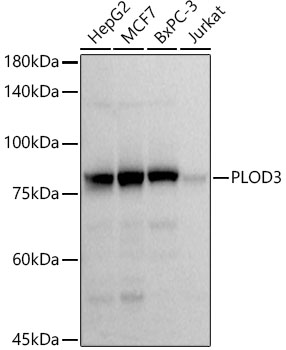 PLOD3 Monoclonal Antibody [5R6Q9]