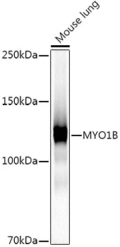 MYO1B Monoclonal Antibody [3W1C6]