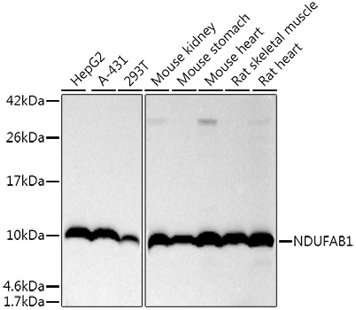 NDUFAB1 Monoclonal Antibody [4E8D5]