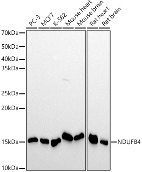 NDUFB4 Monoclonal Antibody [6R6H9]