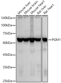 PGM1 Monoclonal Antibody [2P5U4]