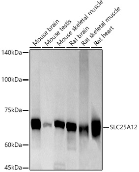 SLC25A12 Monoclonal Antibody [10C5X2]
