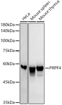 PRPF4 Monoclonal Antibody [7U1K8]