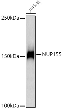 NUP155 Monoclonal Antibody [9I10M5]