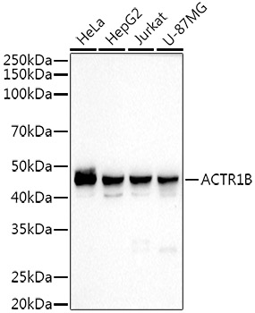 ACTR1B Monoclonal Antibody [8U6H3]&nbsp;<img src="images/icon_newarrival.gif" alt="new" border="0">