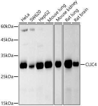 CLIC4 Monoclonal Antibody [6O0W5]