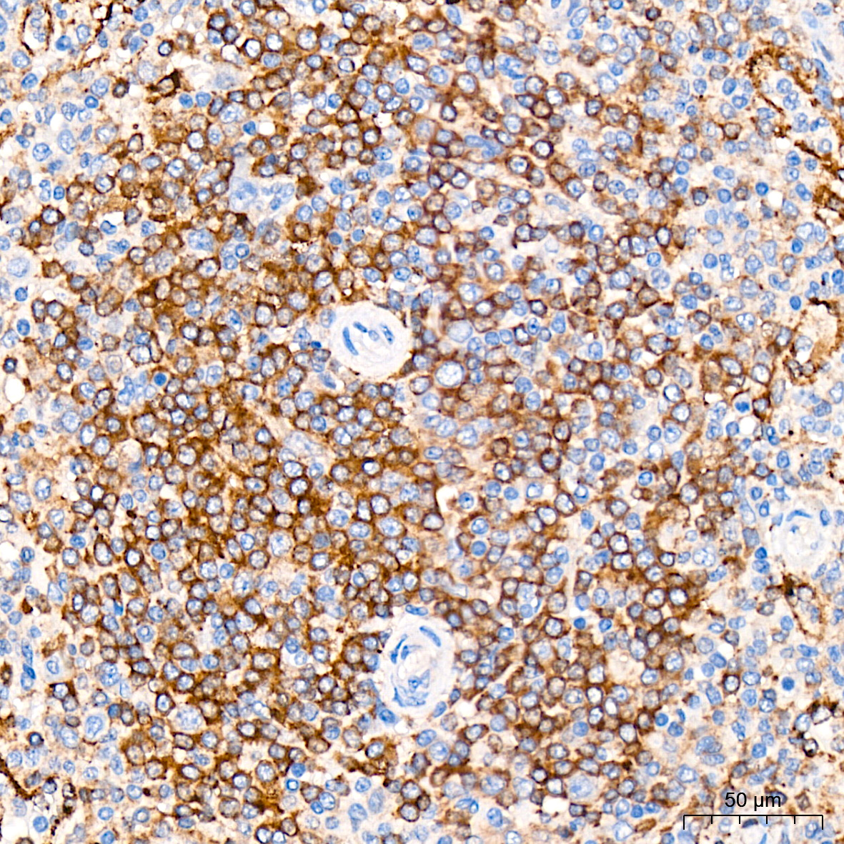 SNX5 Monoclonal Antibody [6S4M10]