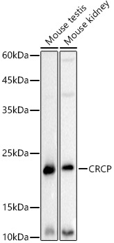 CRCP Monoclonal Antibody [0I6F10]