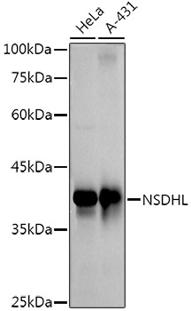 NSDHL Monoclonal Antibody [3K3Q6]