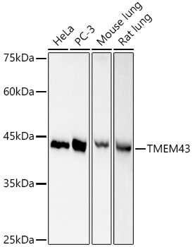 TMEM43 Monoclonal Antibody [4E6A1]