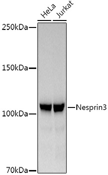 Nesprin3 Monoclonal Antibody [5P10J3]