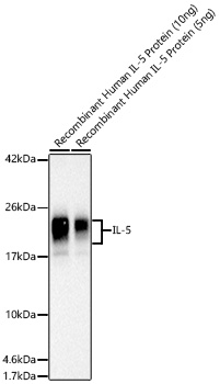 Human IL-5 Polyclonal Antibody