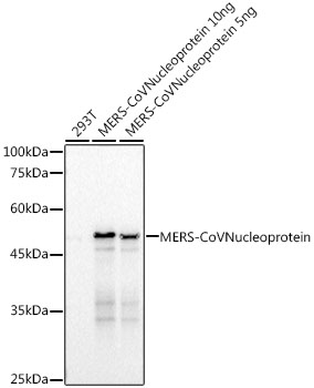 MERS-CoV Nucleoprotein Monoclonal Antibody [1R8L7]