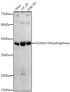 Sorbitol Dehydrogenase Polyclonal Antibody