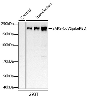 SARS-CoV Spike RBD Monoclonal Antibody [8H6J10]