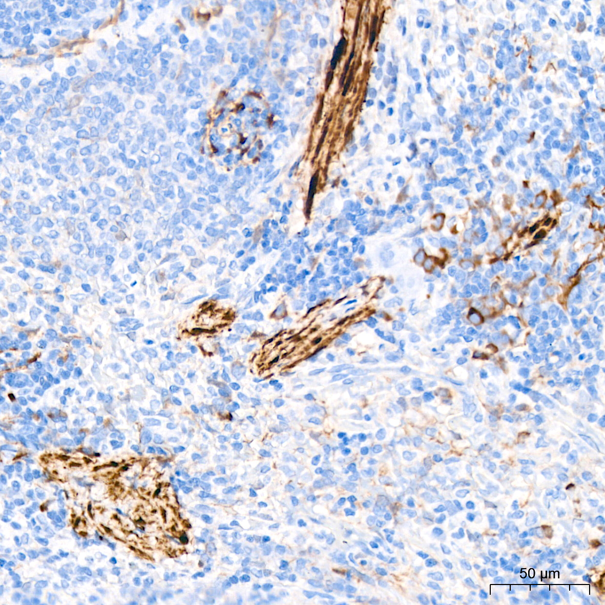 Transgelin (TAGLN) Monoclonal Antibody
