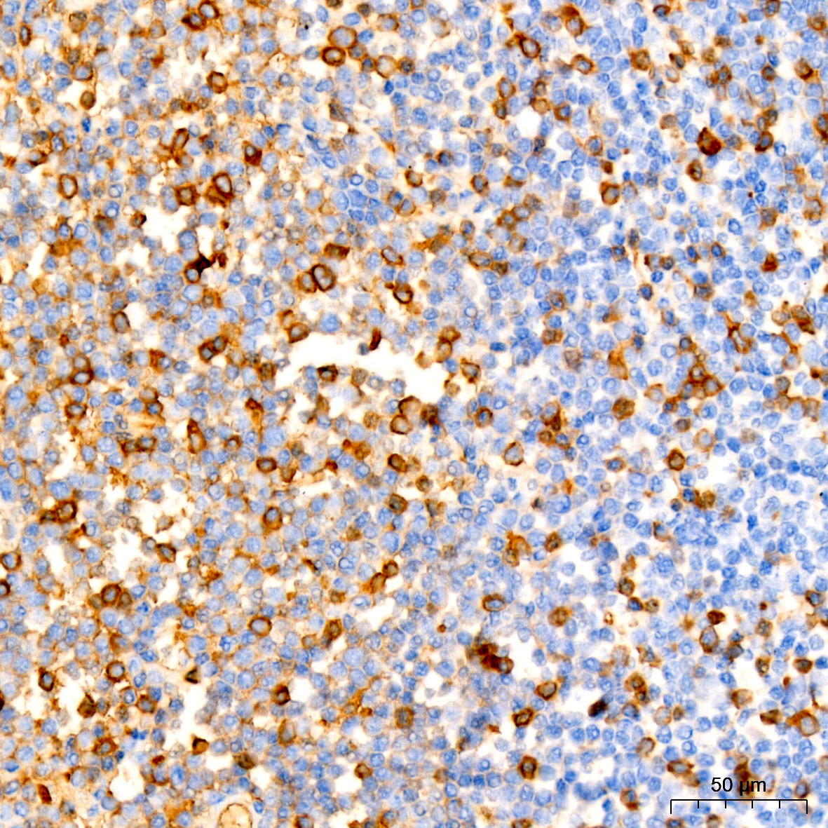 human IgG (Fc) Monoclonal Antibody [10R2H2]
