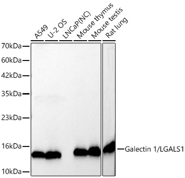 Galectin 1/LGALS1 Monoclonal Antibody [9B6D1]