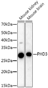 PHD3 Monoclonal Antibody [2R1E6]