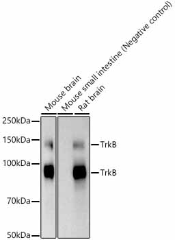 TrkB Monoclonal Antibody [4S7R7]