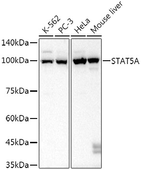 STAT5A Monoclonal Antibody [10Q7R1]
