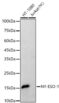 NY-ESO-1 Monoclonal Antibody [3G2U6]