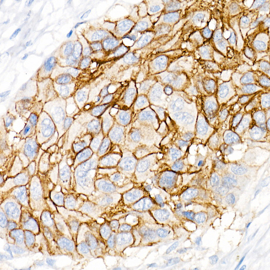 CD141/Thrombomodulin Monoclonal Antibody