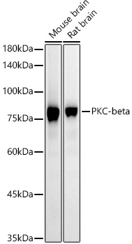 PKC-beta Monoclonal Antibody [4A3C9]
