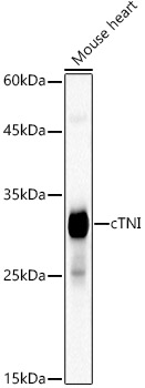 Cardiac Troponin I (TNNI3) Monoclonal Antibody [8Y3Q2]