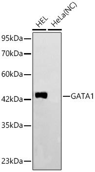 GATA1 Monoclonal Antibody [1T2E4]