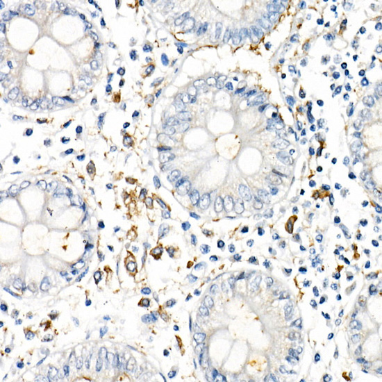 TNF-a Monoclonal Antibody [2Y4O4]