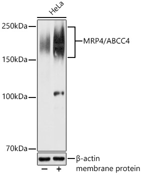 MRP4/ABCC4 Polyclonal Antibody