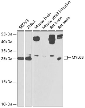 MYL6B Polyclonal Antibody