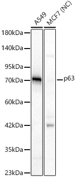 p63 Polyclonal Antibody