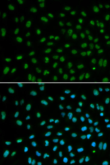 DDB2 Polyclonal Antibody