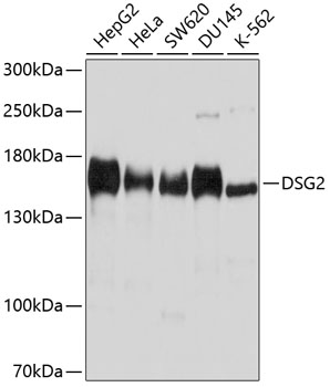 DSG2 Polyclonal Antibody