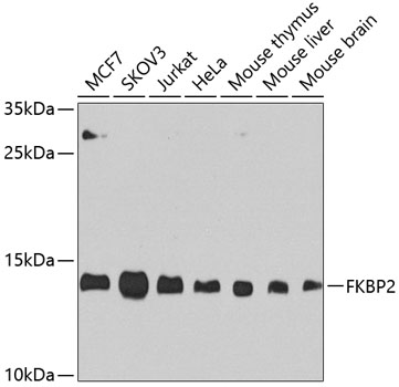 FKBP2 Polyclonal Antibody