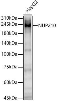 NUP210 Polyclonal Antibody