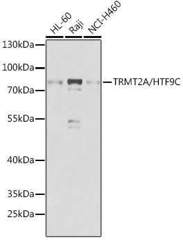 TRMT2A/HTF9C Polyclonal Antibody